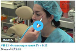 Обучающих видео по имплантации нитей Excellence Visage